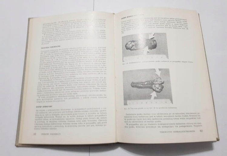 STARA KSIĄŻKA PODSTAWY CHIRURGI ENDOKRYNOL. 1978