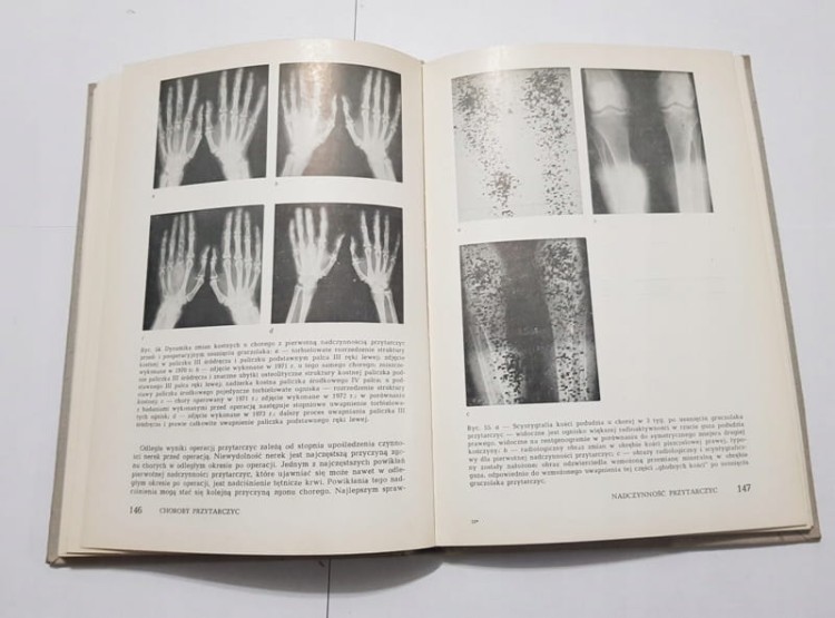 STARA KSIĄŻKA PODSTAWY CHIRURGI ENDOKRYNOL. 1978