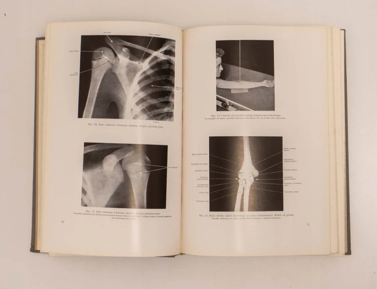 STARA KSIĄŻKA ANATOMIA RENTGENOWSKA 1961