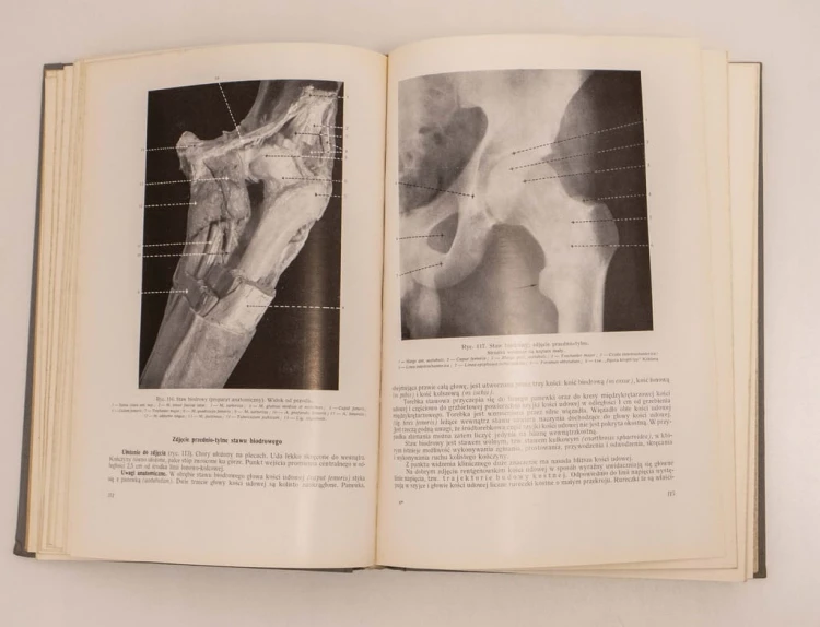 STARA KSIĄŻKA ANATOMIA RENTGENOWSKA 1961