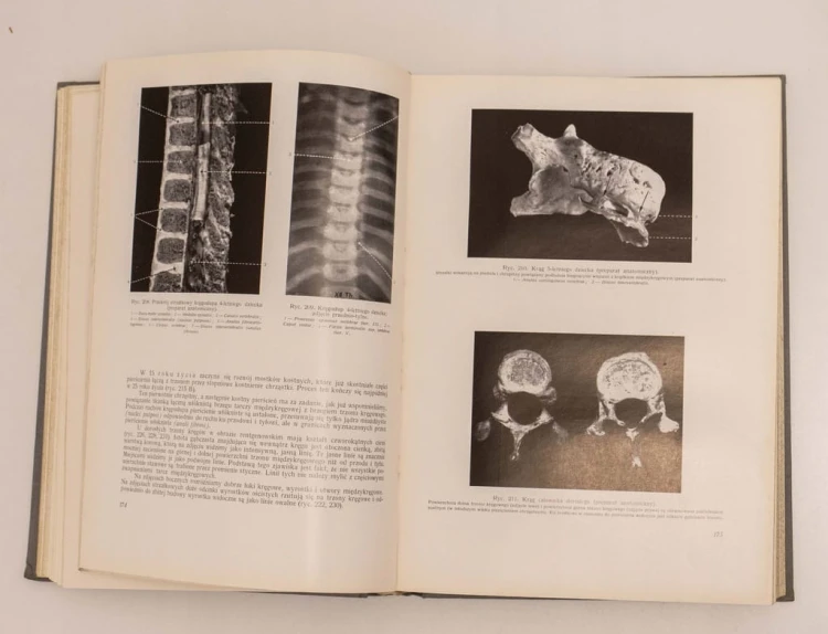 STARA KSIĄŻKA ANATOMIA RENTGENOWSKA 1961