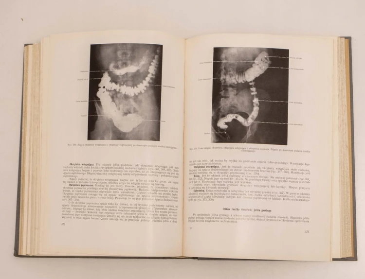 STARA KSIĄŻKA ANATOMIA RENTGENOWSKA 1961