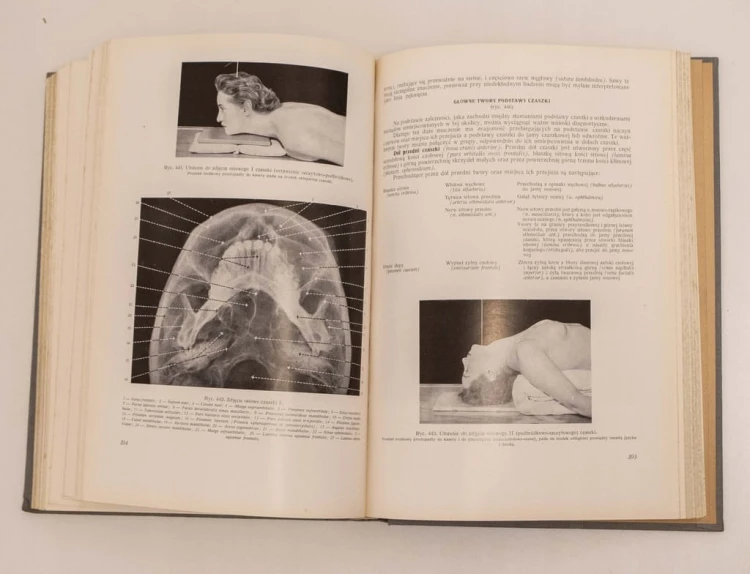 STARA KSIĄŻKA ANATOMIA RENTGENOWSKA 1961